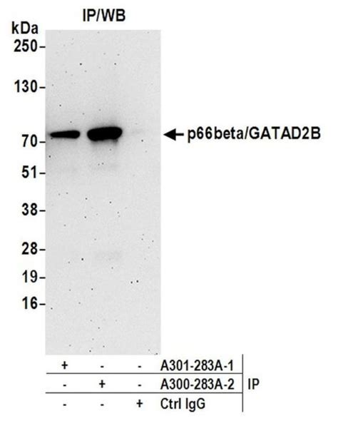 p66 beta (GATAD2B) (NM.